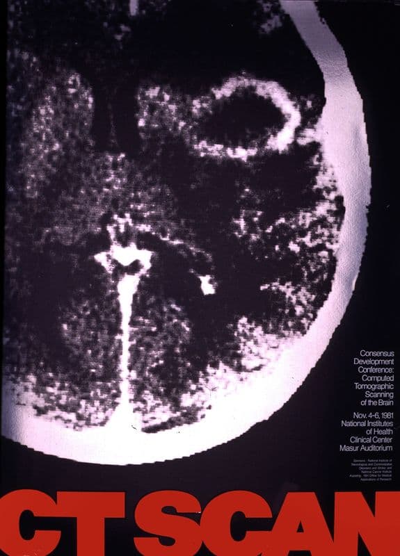 CT scan as a canvas print