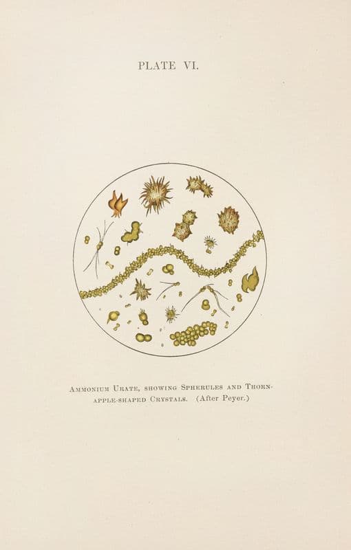 Plate VI: Ammonium Urate, Showing Spherules and Thorn-Apple-Shaped Crystals as a canvas print