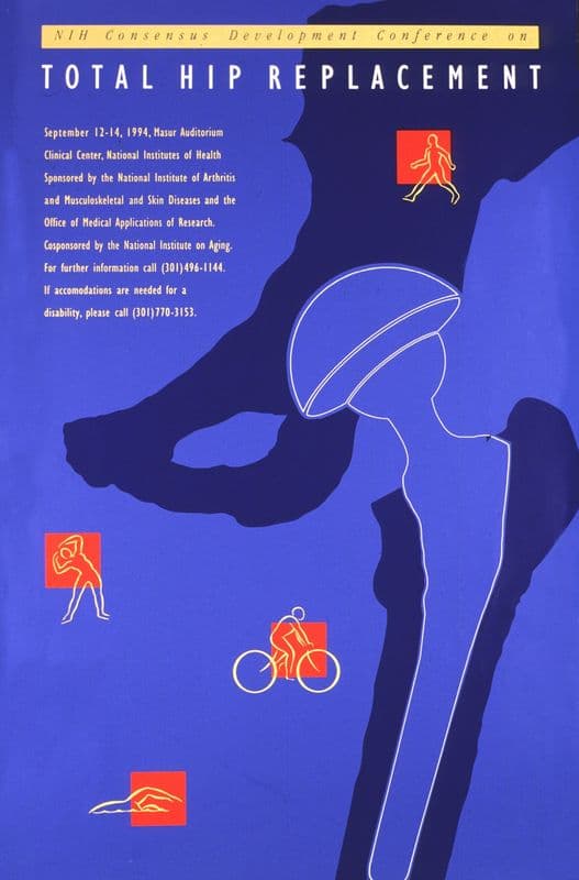Total hip replacement as a canvas print